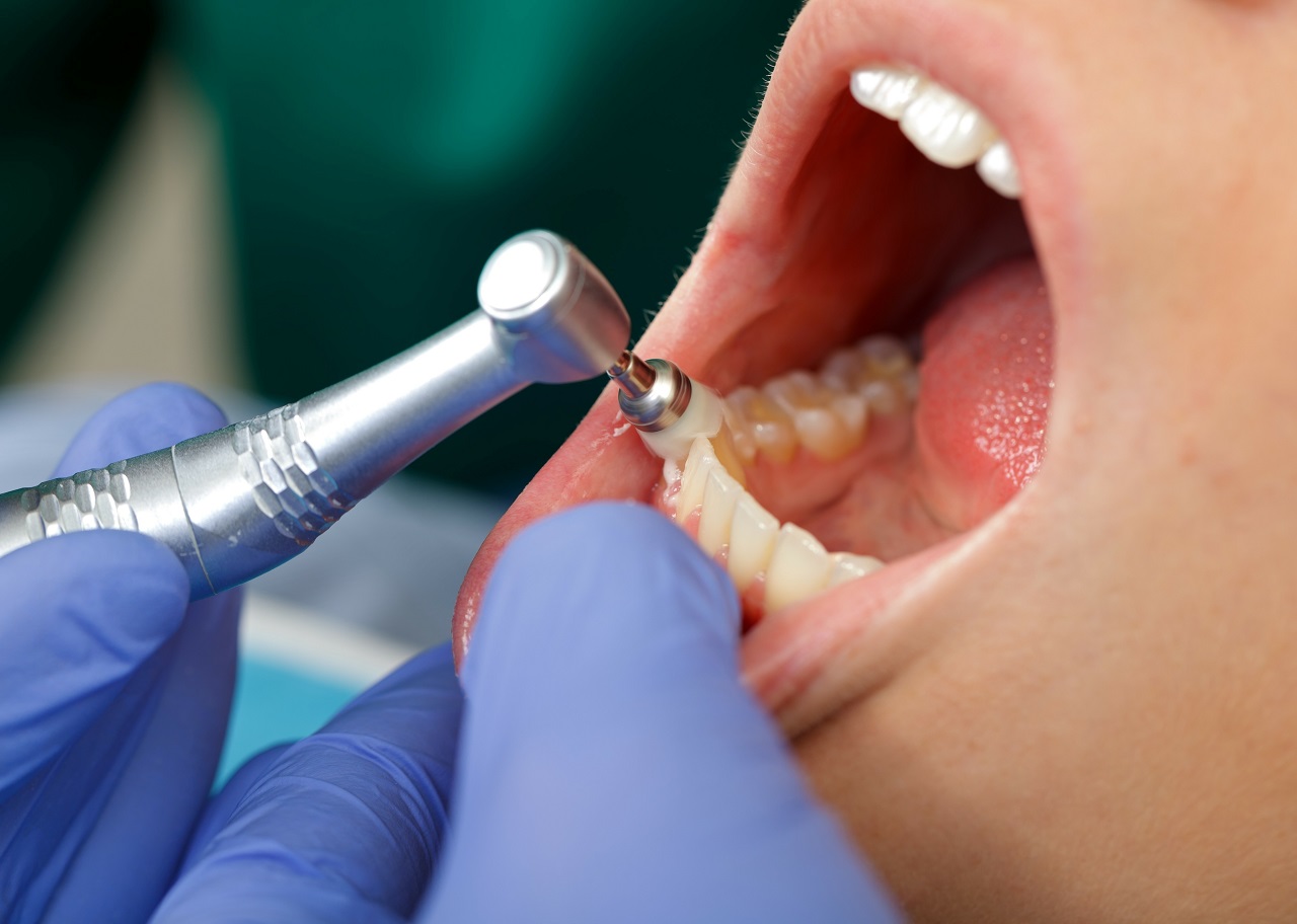 Jakimi chorobami zajmuje się stomatolog?