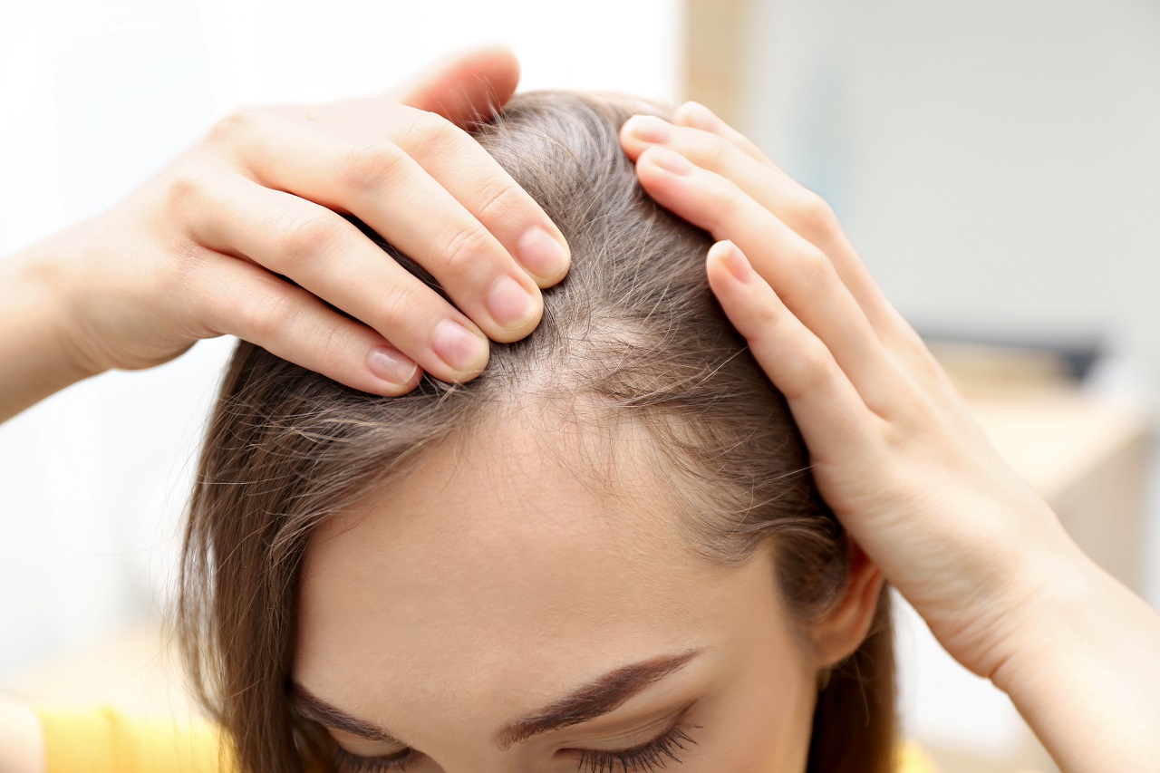 Problemy z łysieniem – co zrobić, żeby cieszyć się bujną fryzurą?